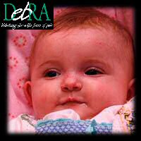 Maisy DebRA